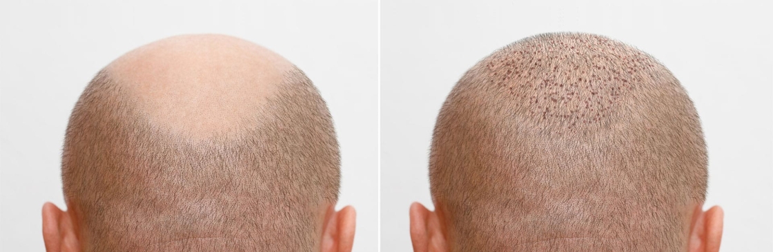 Cosmo Care and Hair Clinic Cover Image