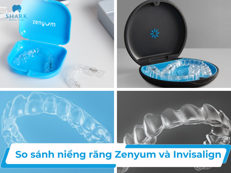 So sánh niềng răng Zenyum và Invisalign khác biệt ra sao?