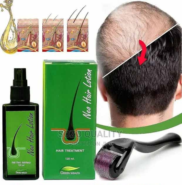 Buy Neo Hair Lotion Oil Green Wealth in Pakistan - Best Hair Regrowth Solution