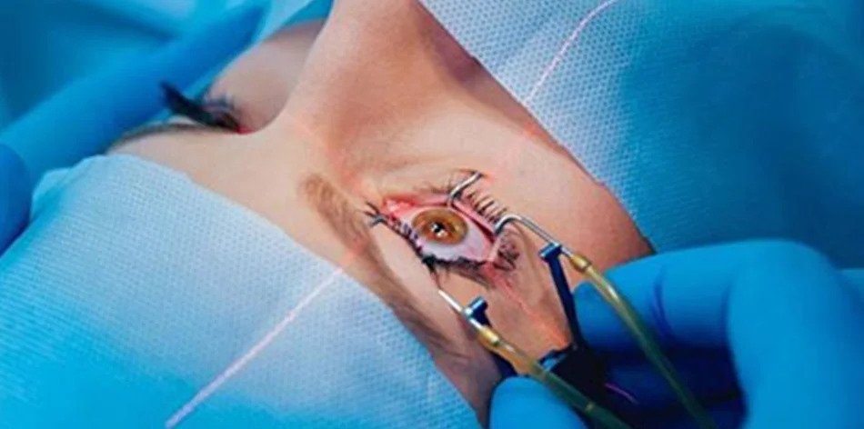 Best Lasik Eye Surgery Clinic in Delhi