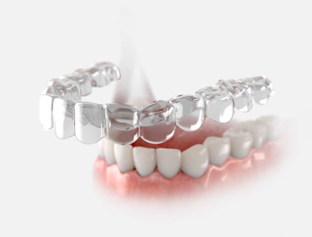 Invisalign Treatment Explained: Pros, Cons & Preparation Tips | Pair Orthodontics