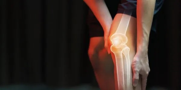 What to Expect Before and After Knee Replacement Surgery