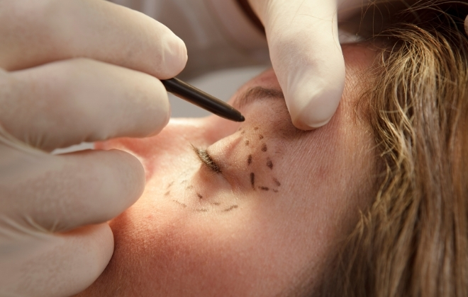 Best Plastic & Cosmetic Surgery in India | SNSIPS Hospital Lucknow