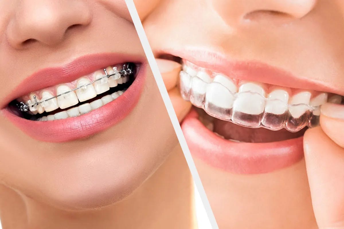 Orthodontist in RR Nagar at Symphony Smiles | by Symphonysmiles | Jun, 2025 | Medium