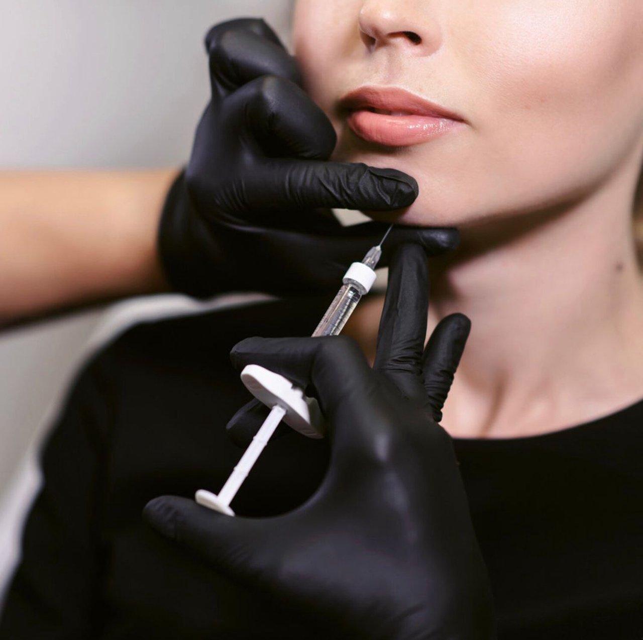 Lip Flip Near Me: The Effective Way to Enhance Your Smile Without Fillers | Articles | The Onyxx Luxe Esthetics | Gan Jing World - Technology for Humanity | Video & Movie Streaming