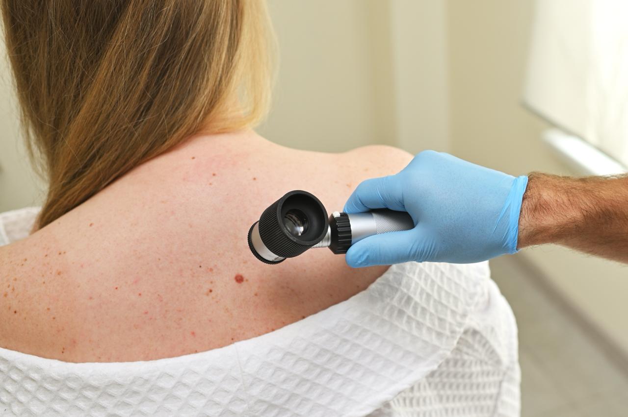 Private Dermatologist Montreal, West island, Laval & South Shore