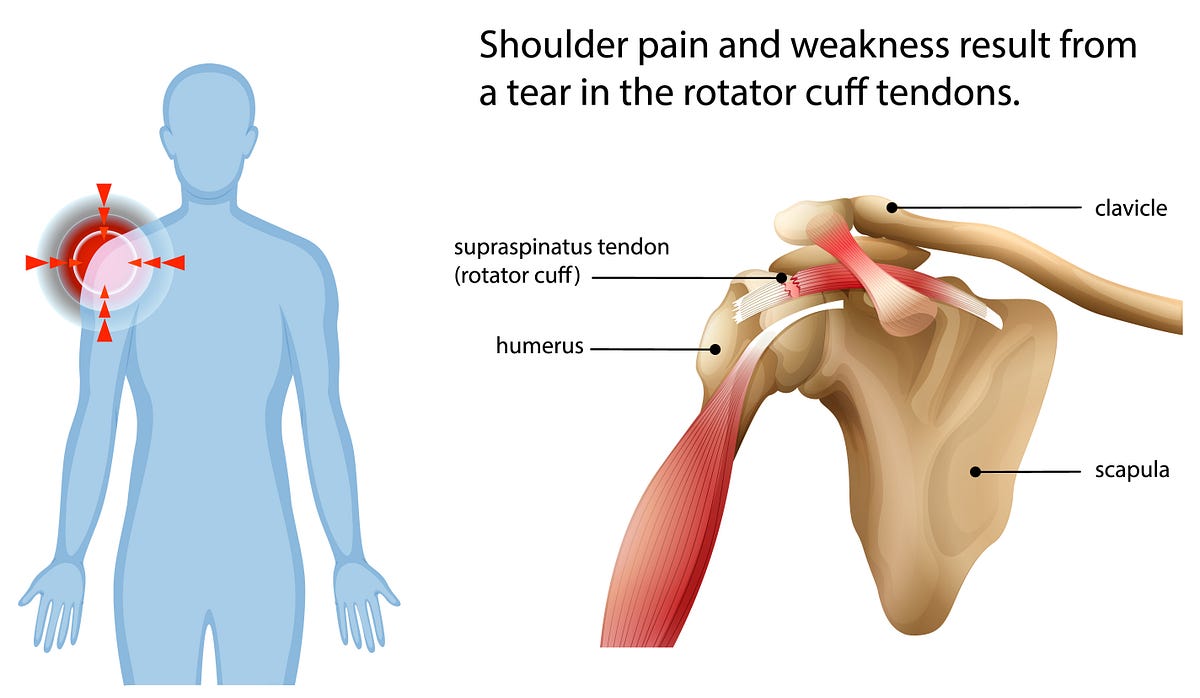Shoulder and Elbow Replacement: What to Expect Before and After Surgery | by Drvasudevaj | Jul, 2025 | Medium
