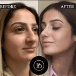 PRP Treatment Profile Picture
