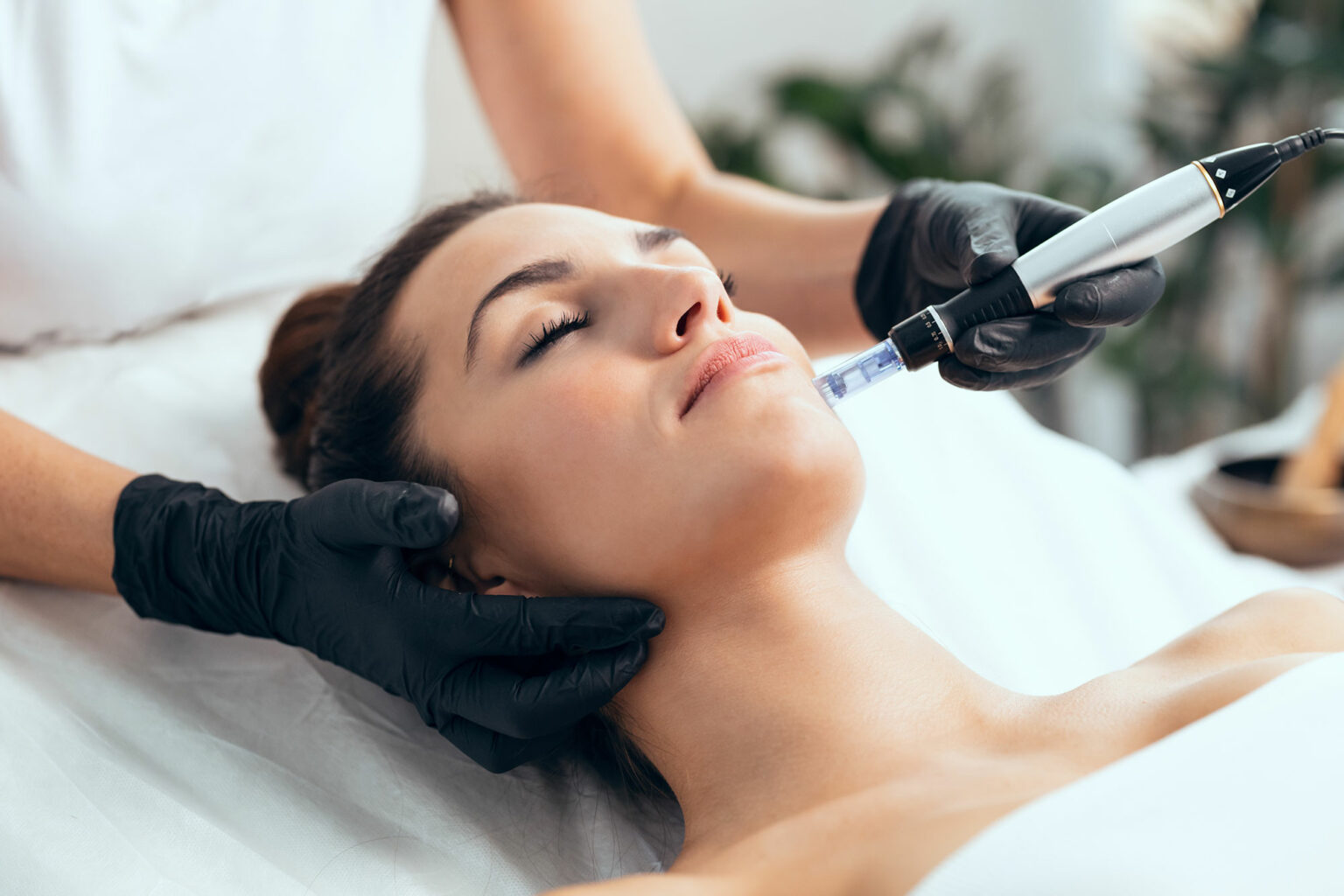 From Dull to Radiant: Microneedling Facial Transformations with PRP