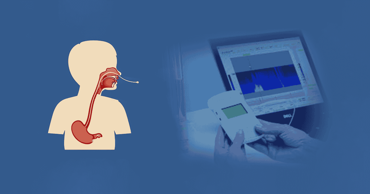 Esophageal Manometry and 24-Hour pH Impedance: Key Strategies for GERD/Acid Reflux