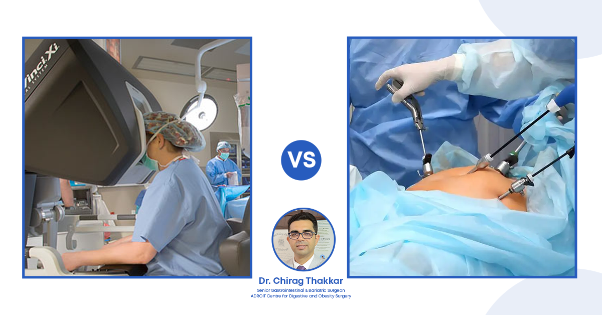 Robotic vs. Laparoscopic Hernia Surgery Differences | Best Options Available in India
