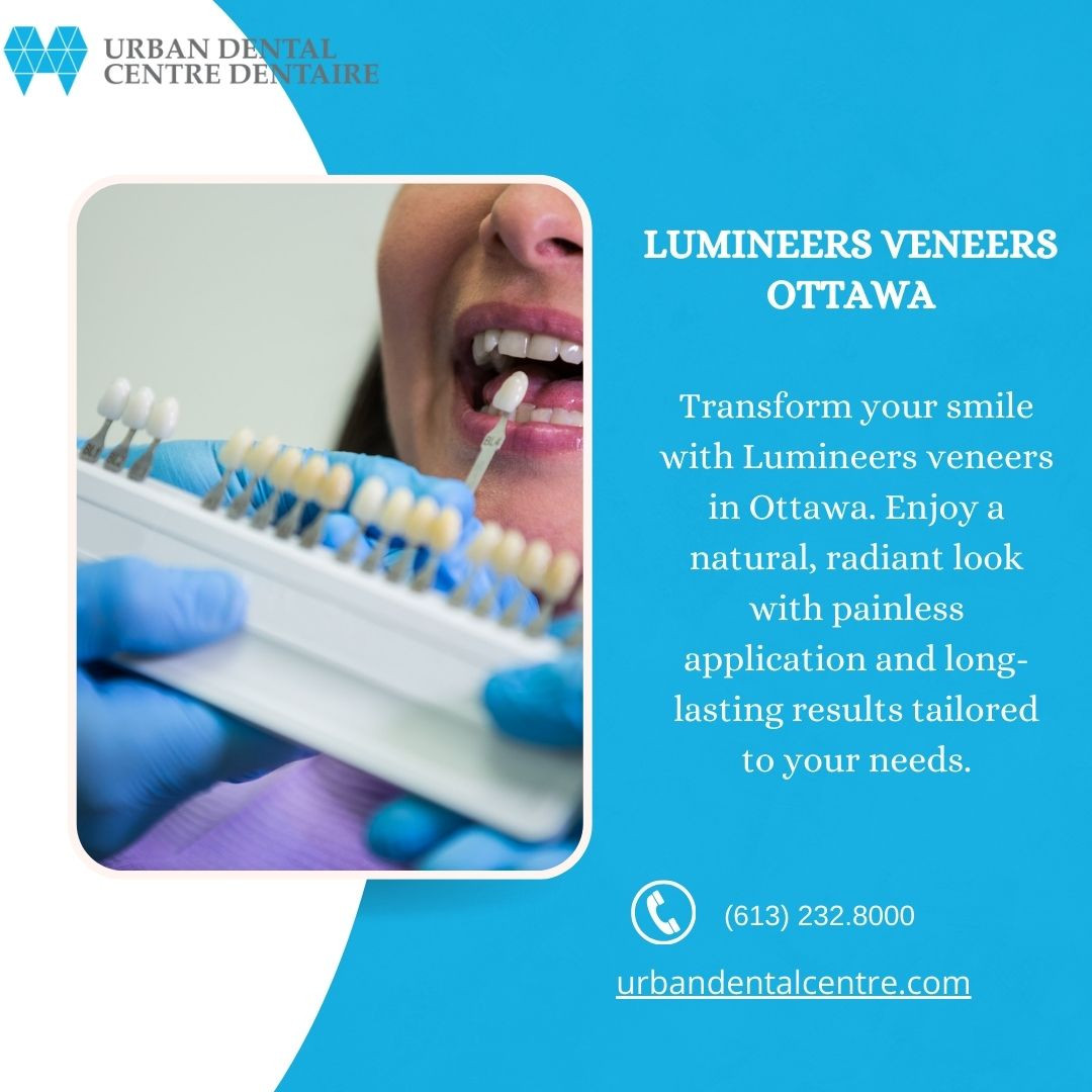 Lumineers Veneers Ottawa | Natural, Long-Lasting S..