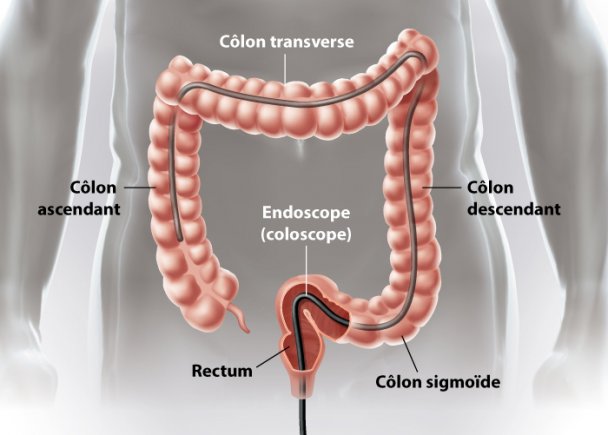 Colonoscopie virtuelle - DiagnostiX