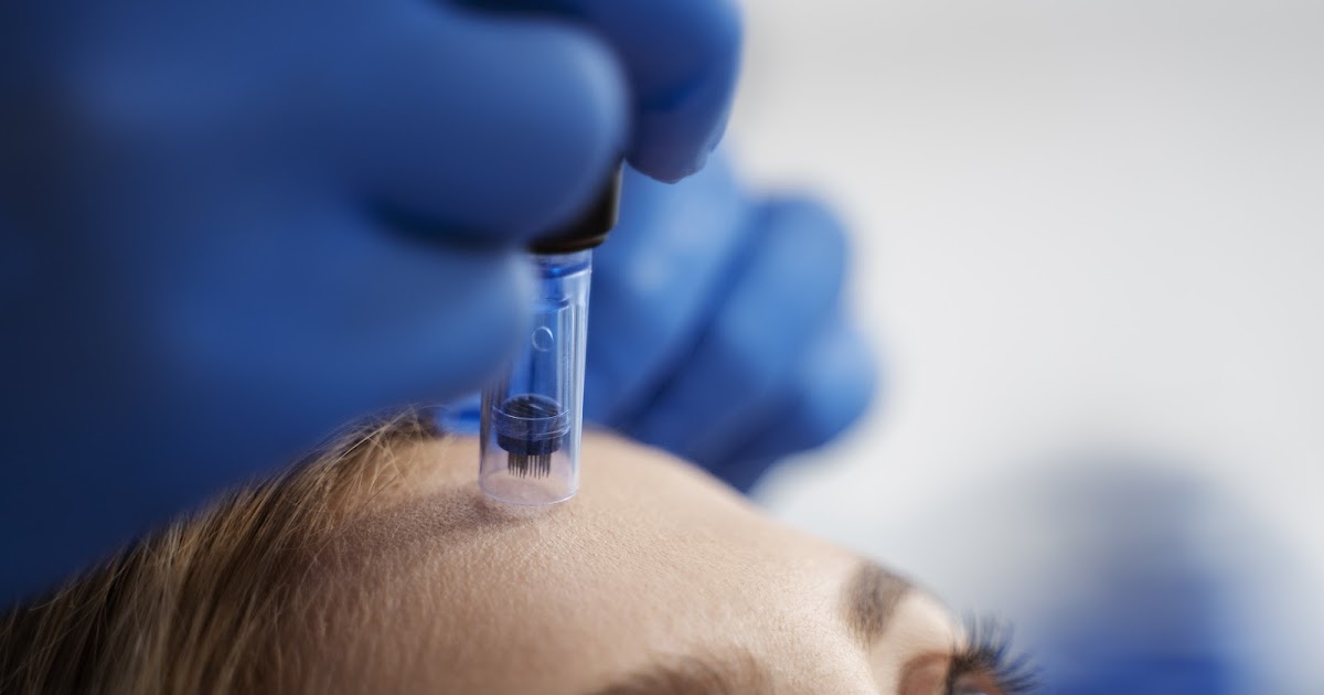 The Ultimate Microneedling Aftercare Checklist UK: Recovery Made Easy