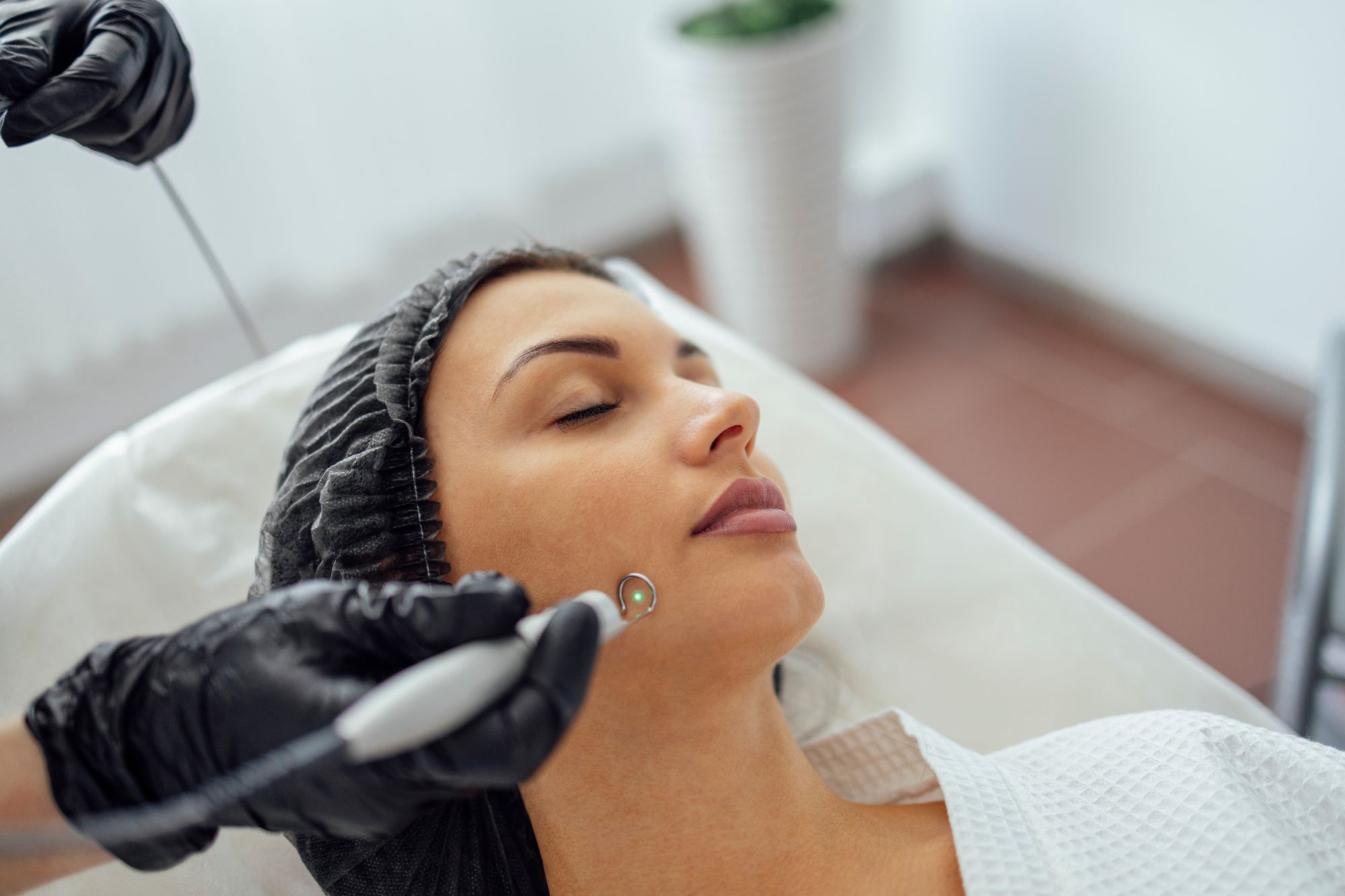 Pimple Scar Removal Price Malaysia | MedicDeno's Guide Sharing