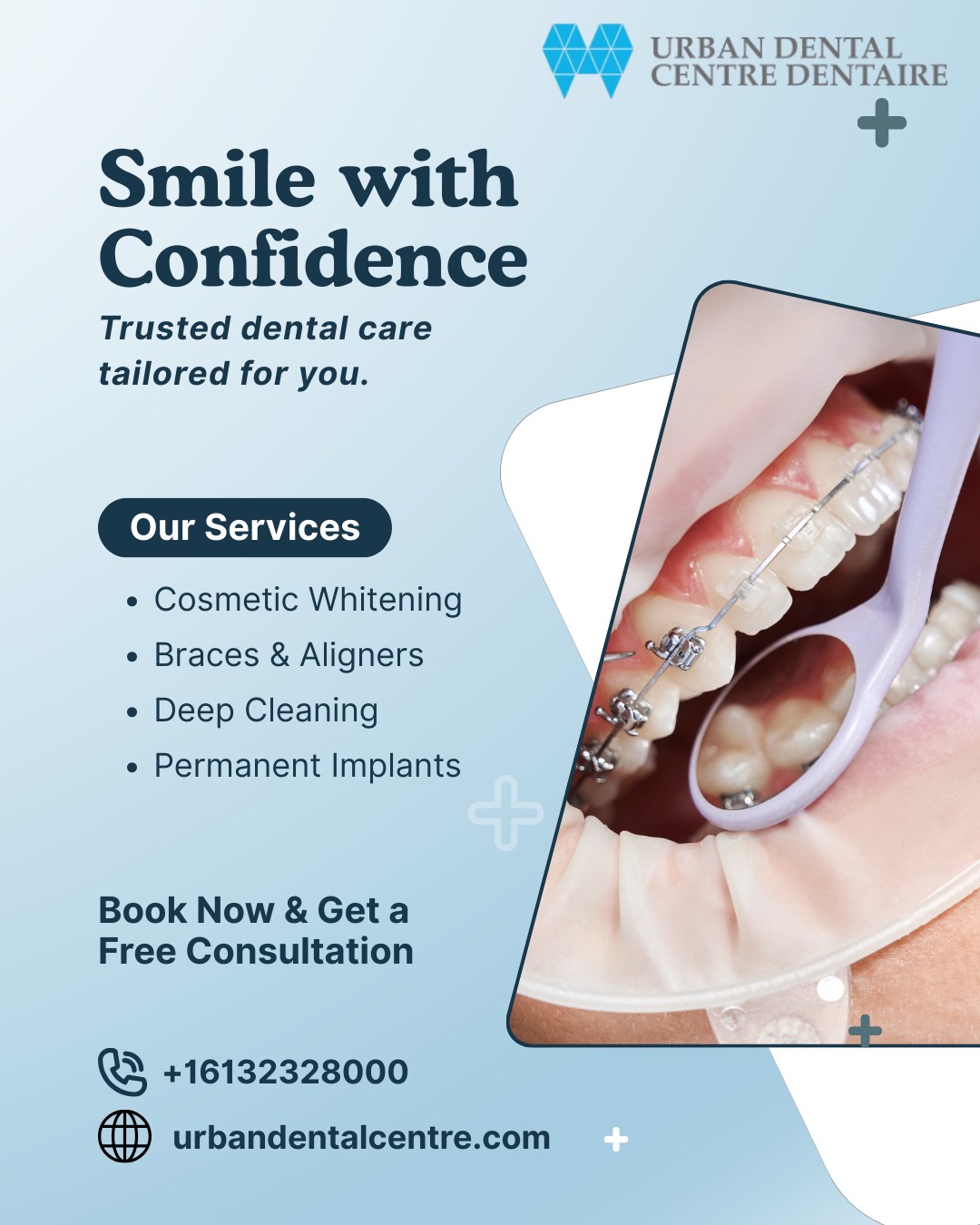 Braces Ottawa – Straighten Your Smile at Urban Den..